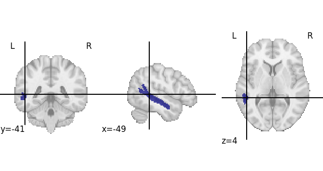 plot load destrieux datalog ir