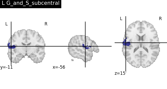 plot load destrieux datalog ir