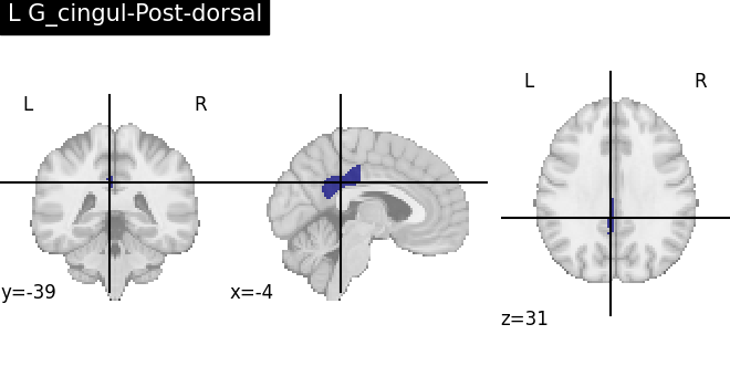 plot load destrieux datalog ir