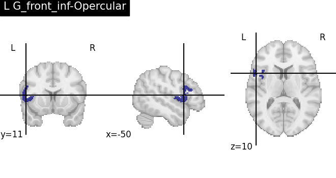 plot load destrieux datalog ir