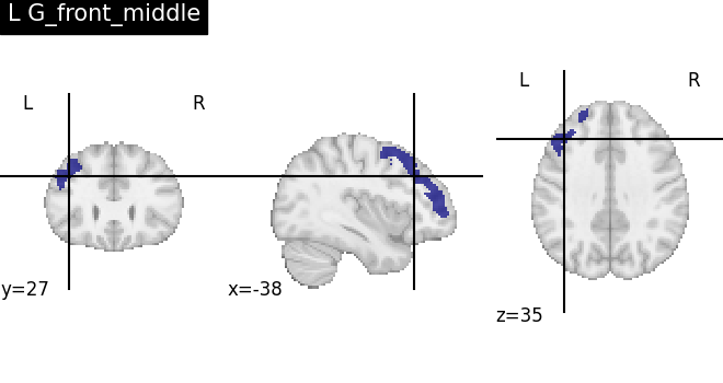 plot load destrieux datalog ir