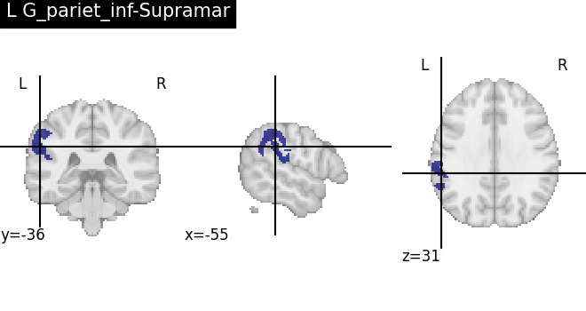plot load destrieux datalog ir