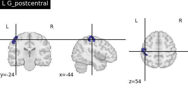 plot load destrieux datalog ir