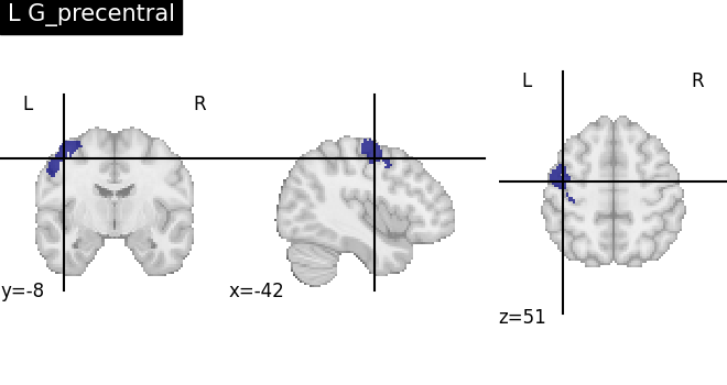 plot load destrieux datalog ir