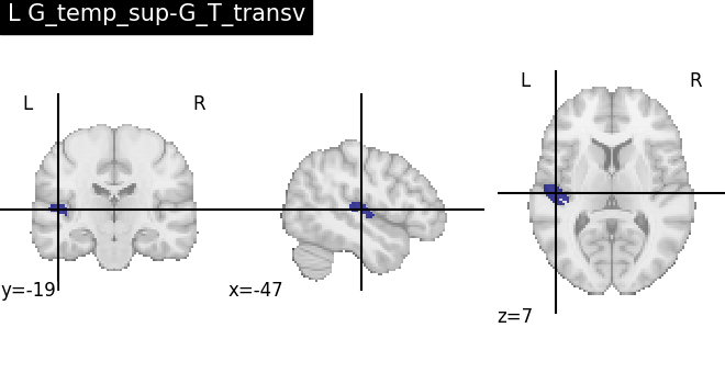 plot load destrieux datalog ir