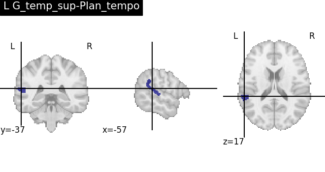 plot load destrieux datalog ir
