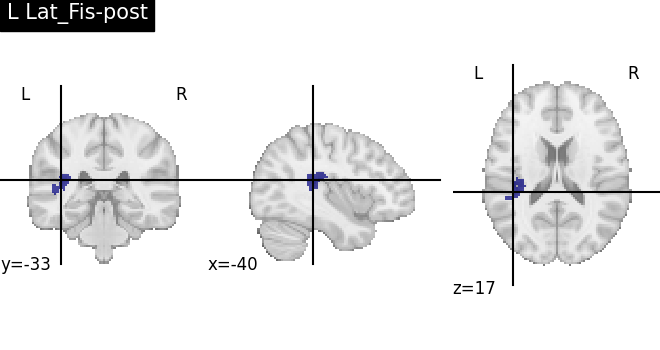 plot load destrieux datalog ir