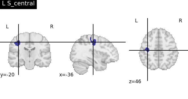plot load destrieux datalog ir