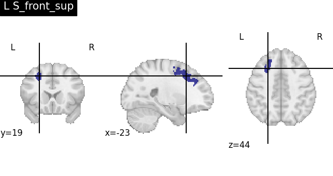 plot load destrieux datalog ir
