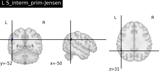 plot load destrieux datalog ir