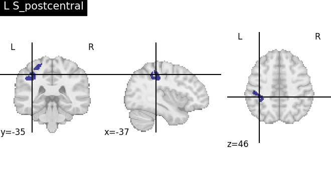 plot load destrieux datalog ir