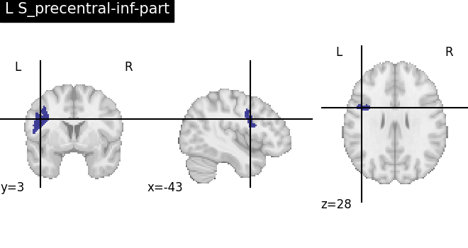 plot load destrieux datalog ir