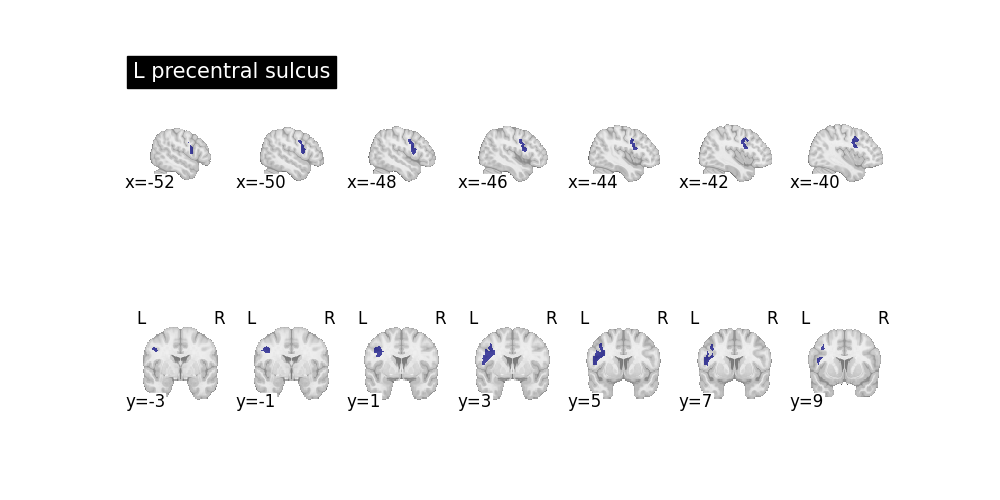 plot sulcal queries