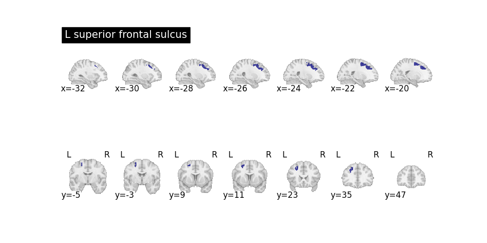 plot sulcal queries